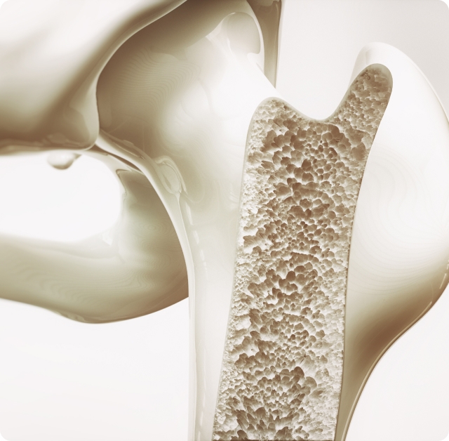 Healthy bone